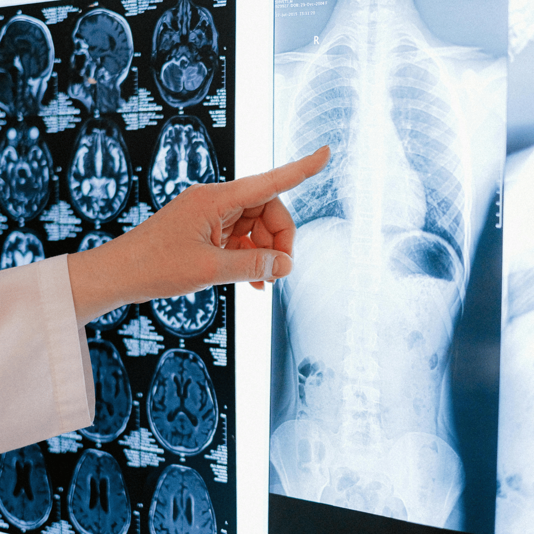 DIGITAL X-RAY
