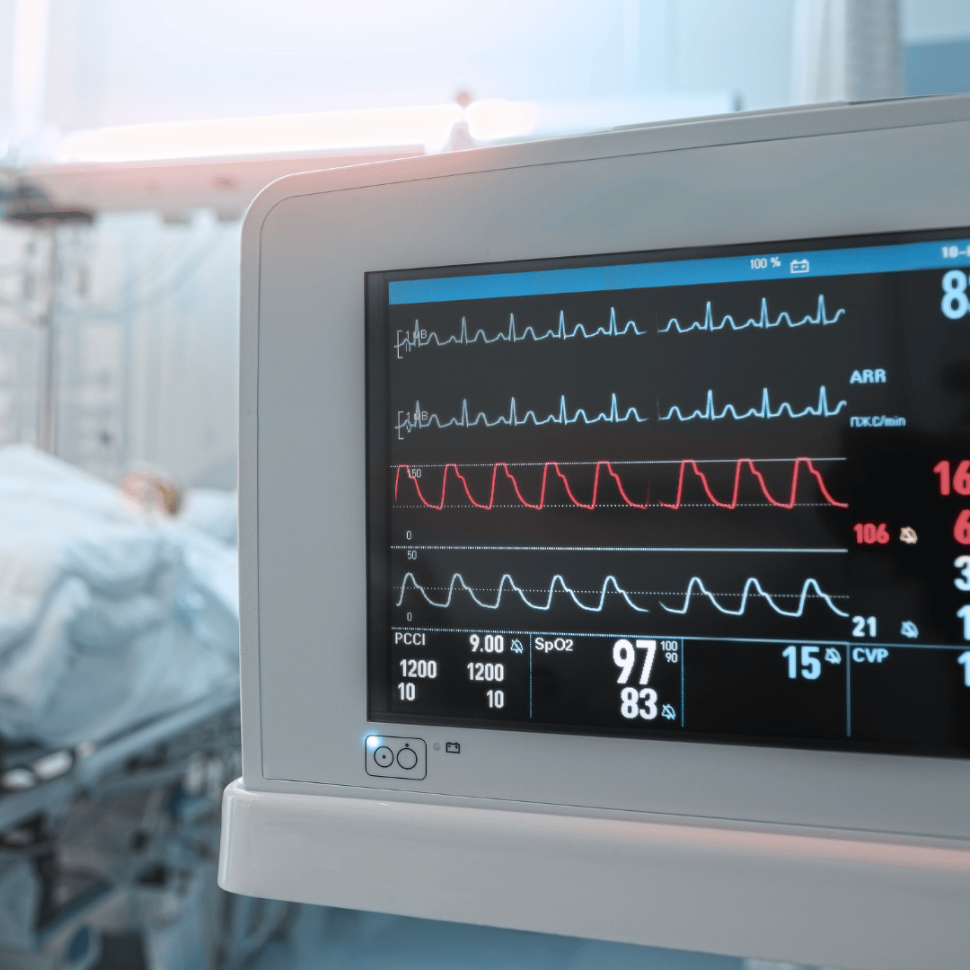 ECG